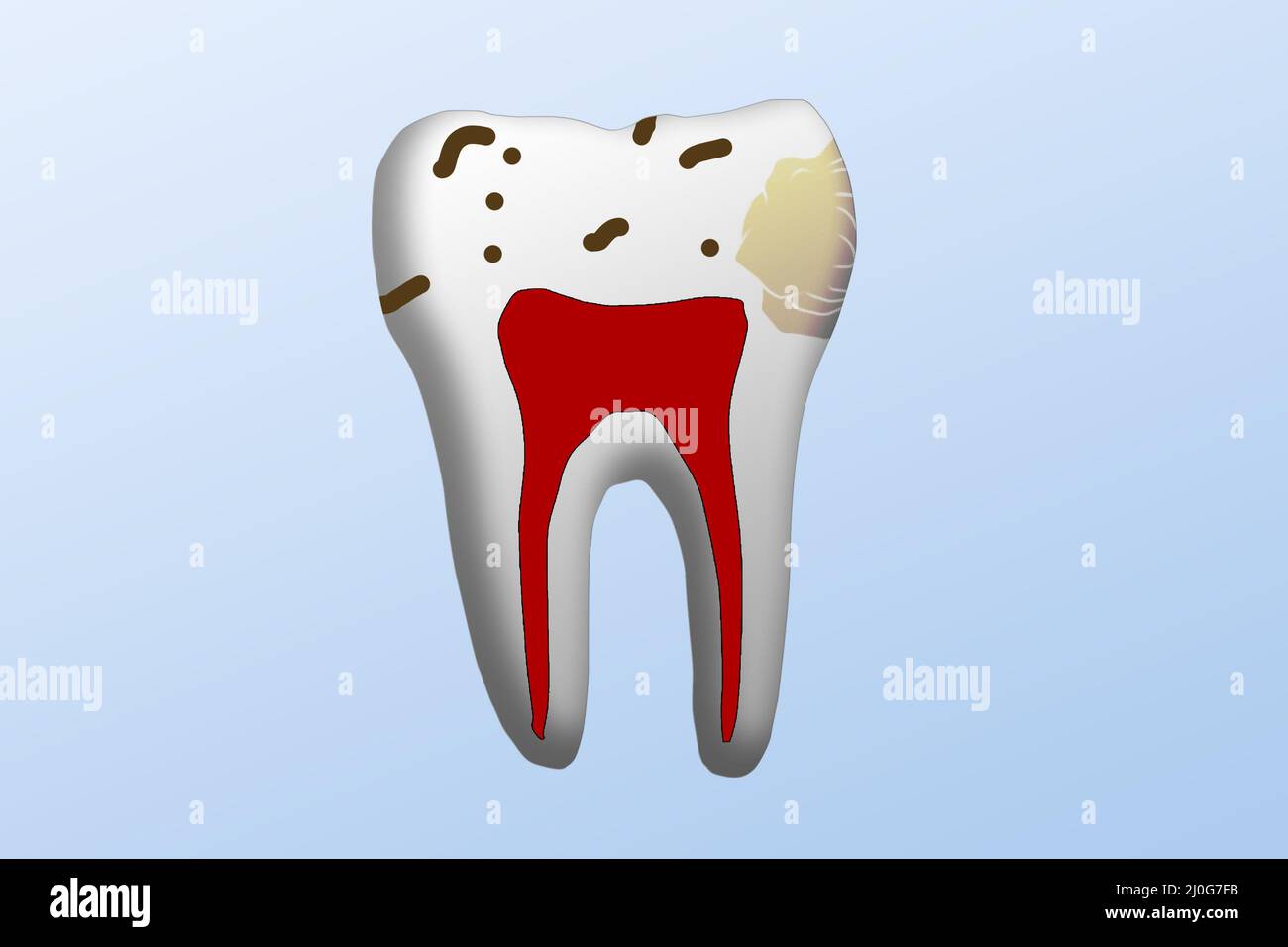 Ilustración de concepto de diente podrido y estropeado. Fondo aislado