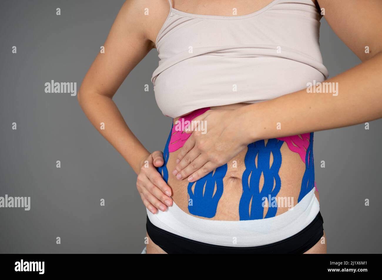 Una mujer joven muestra cintas de kinesio en su cuerpo. Concepto de tapado, esguinces, lesiones y dolor muscular de Kinesio Foto de stock