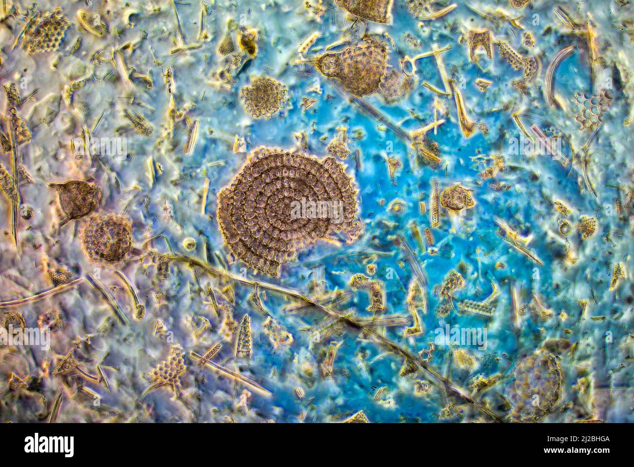 Diatomeas fósiles, radiolaria, espículas esponjosas, Barbados 1800's rica biodiversidad Foto de stock