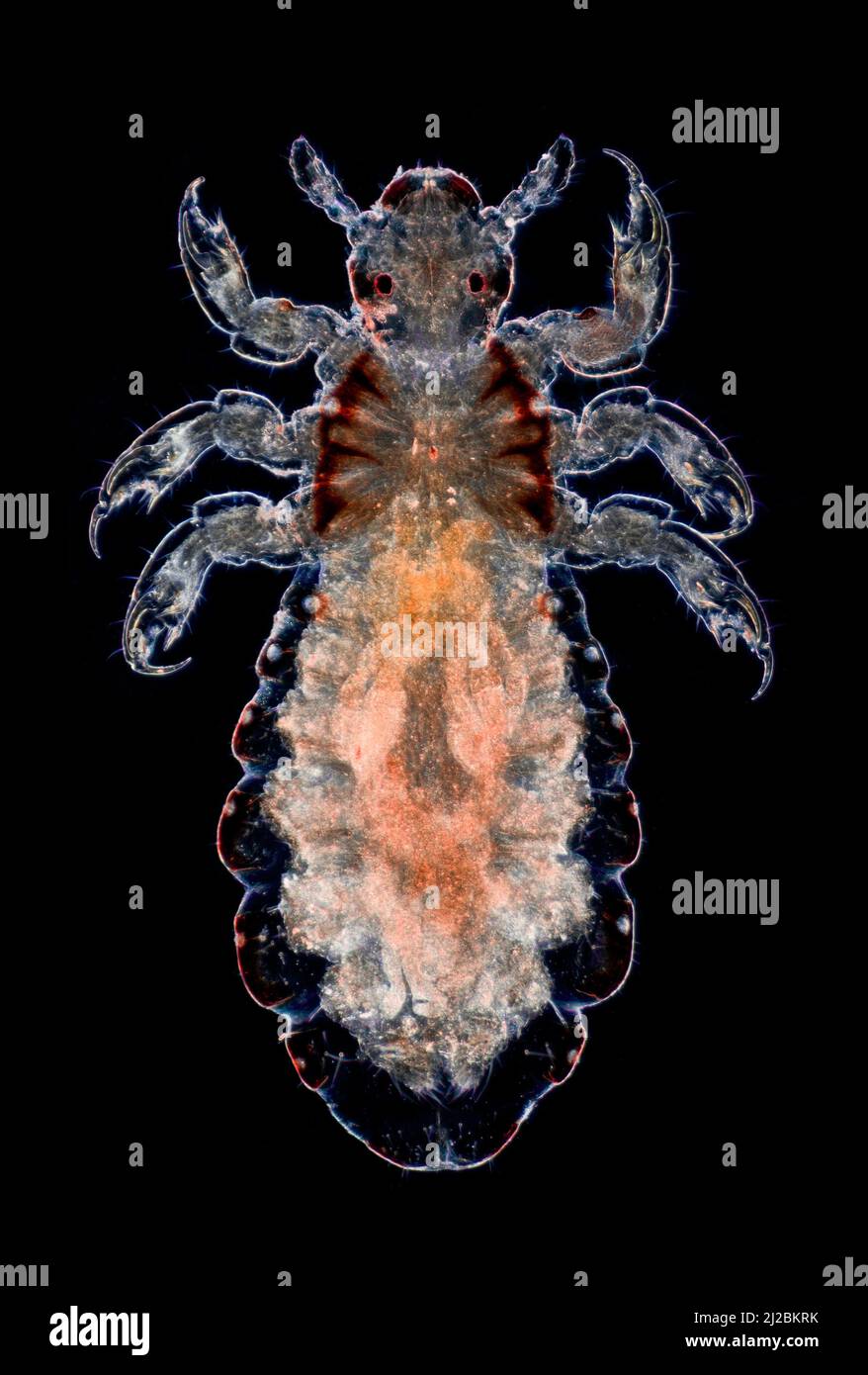 Piojo de cabeza humana, Fotomicrografía de campo oscuro de pediculus humanus capitis Foto de stock