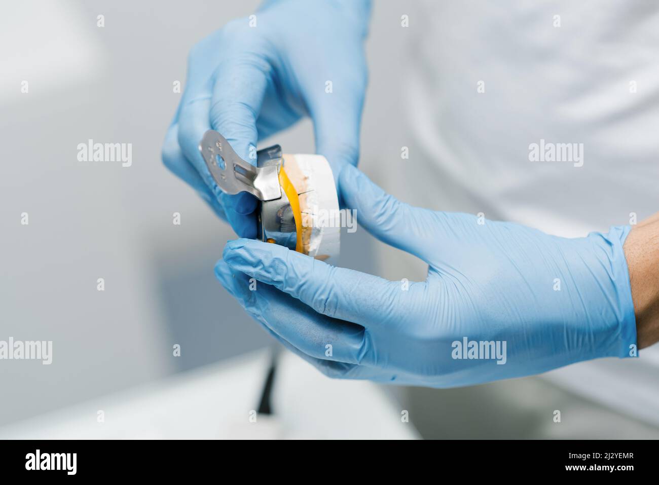 El dentista hace una impresión de los dientes. Primer plano de un dentista con guantes azules Foto de stock