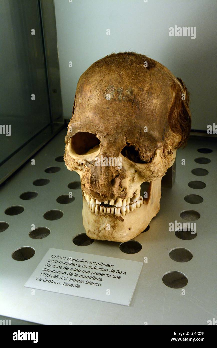 Un cráneo momificado de las momias Guanche, de la antigua comunidad bereber de Tenerife, que se exhibe en un museo en Santa Cruz, Islas Canarias, España. Foto de stock