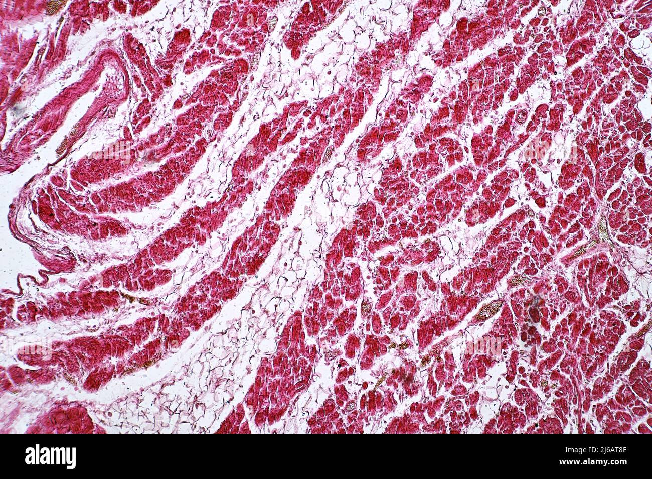 Corazón graso, micrografía ligera Foto de stock