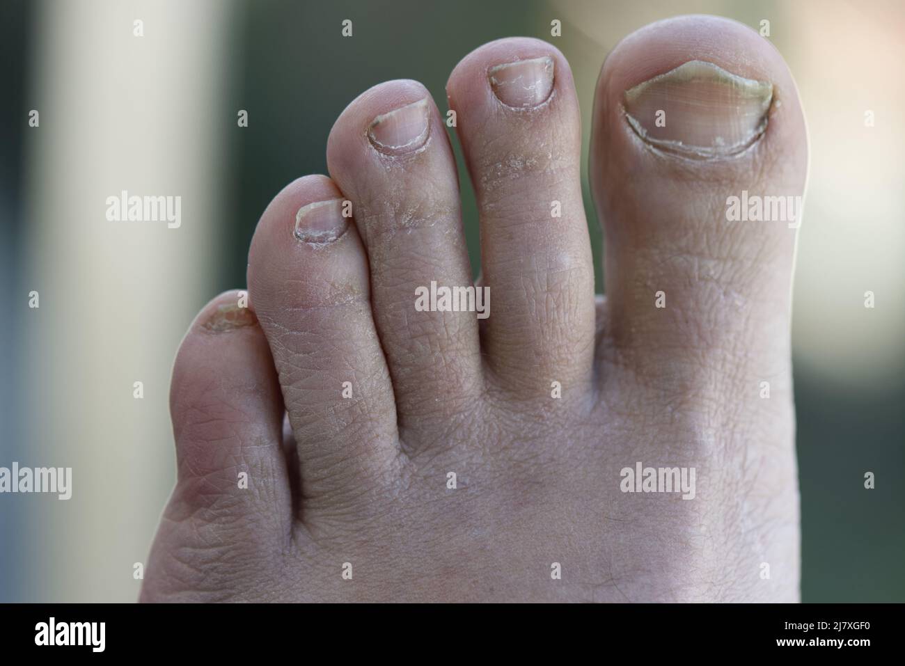 Calcetines cinco dedos- libertad para tus pies – ROOTS