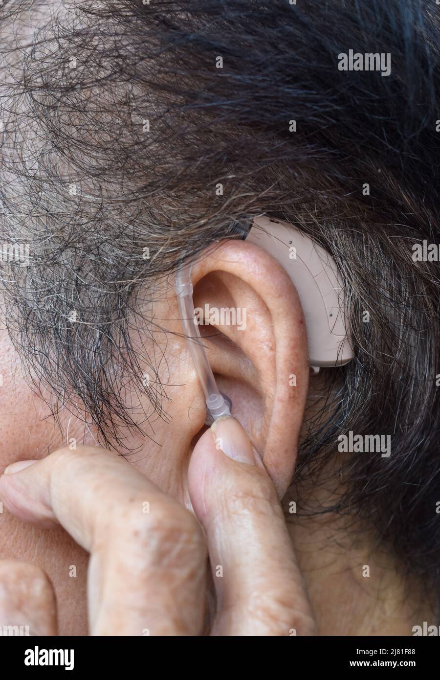 Dispositivo electrónico de ayuda auditiva en el oído de un anciano asiático con sordera total. Foto de stock
