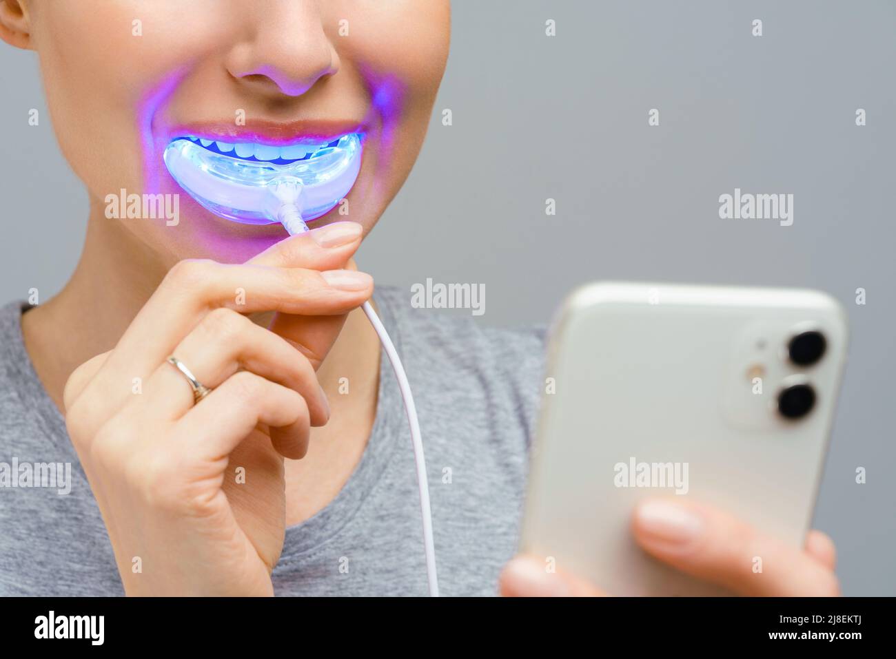 Una mujer sostiene en su mano una lámpara ultravioleta para blanquear los dientes del hogar. Una sonrisa blanca de nieve después de blanquear. Foto de stock