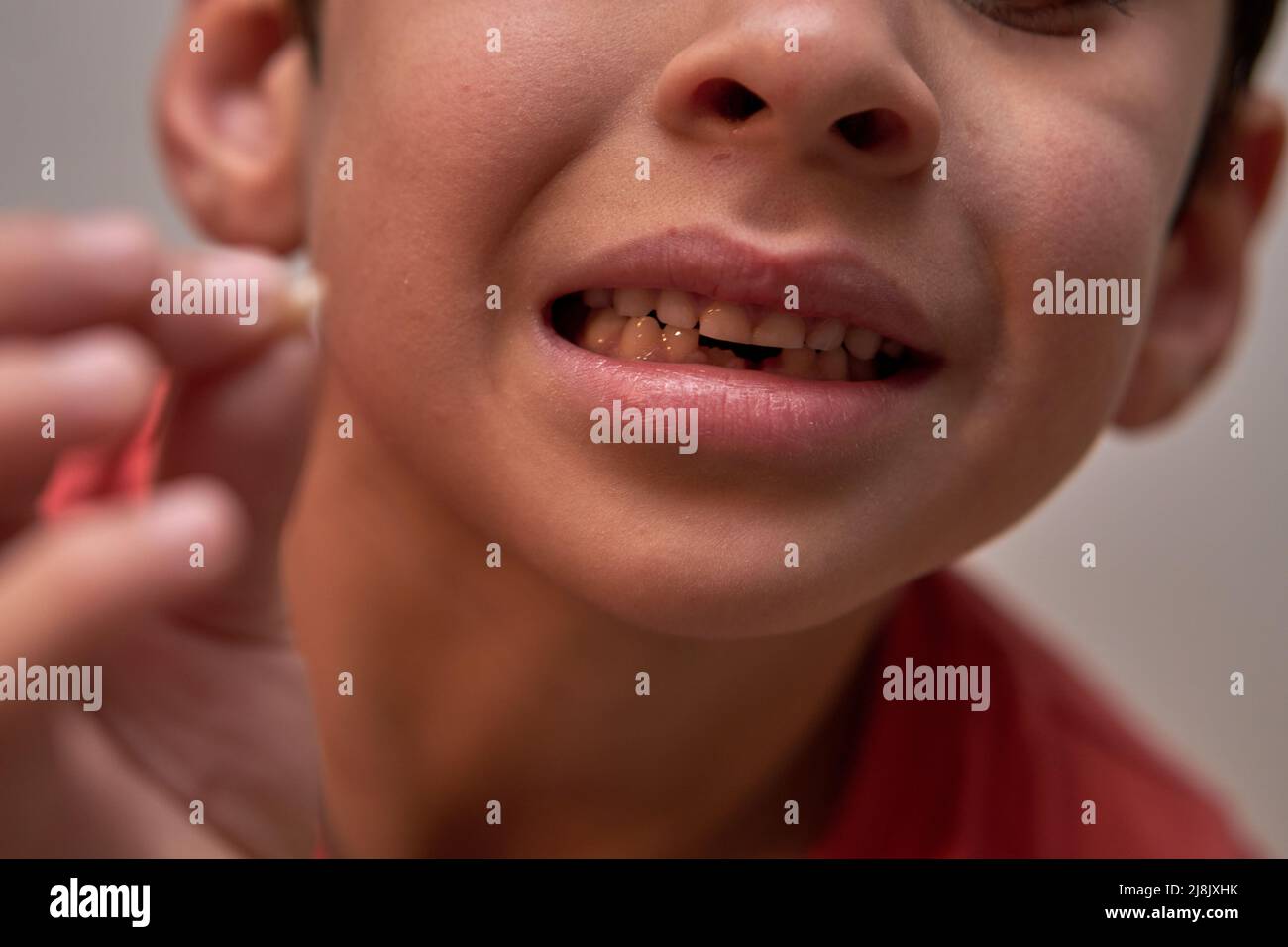 Brunette Kid perdió sus primeros dientes de leche en la parte inferior delantera y los sostenía en sus dedos. Enfoque selectivo Foto de stock