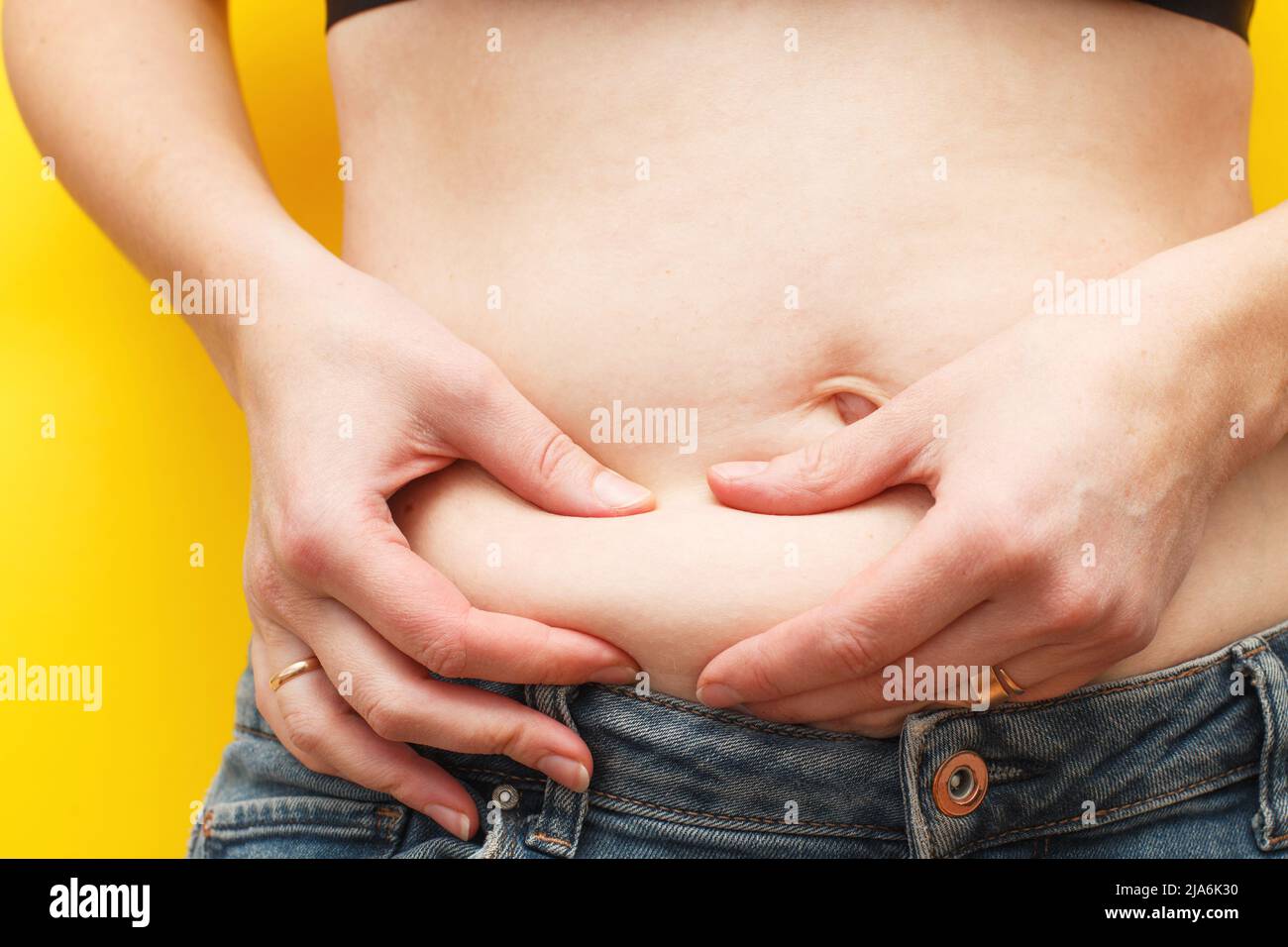 Las manos de la mujer comprimen la grasa de su vientre sobre un fondo amarillo Foto de stock