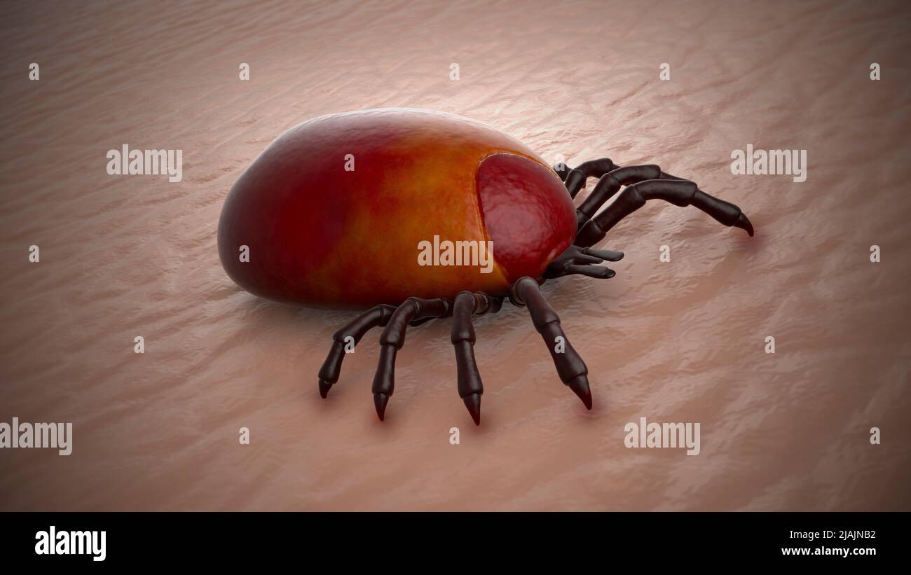 Ilustración biomédica conceptual El tifus de garrapatas de Queensland, una enfermedad transmitida por garrapatas. Foto de stock