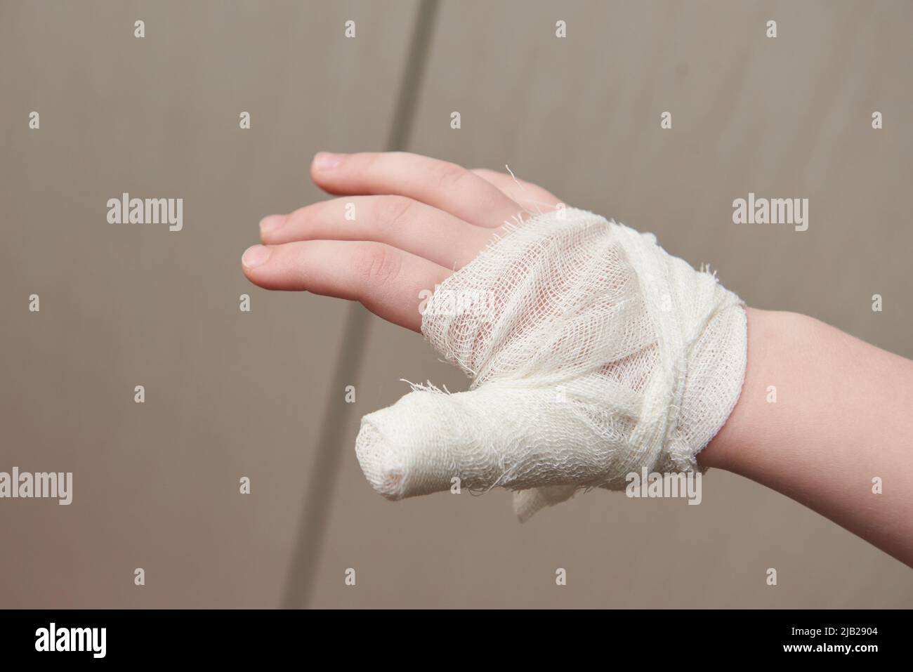 La mano del niño vendada con el pulgar cerca Foto de stock