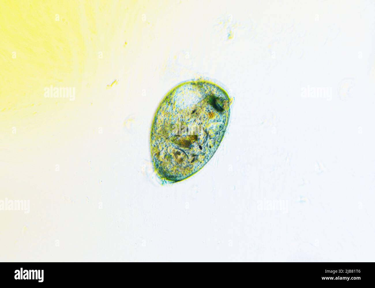 Ciliates Stentor se encuentra en un estanque de agua dulce bajo el microscopio ligero Foto de stock