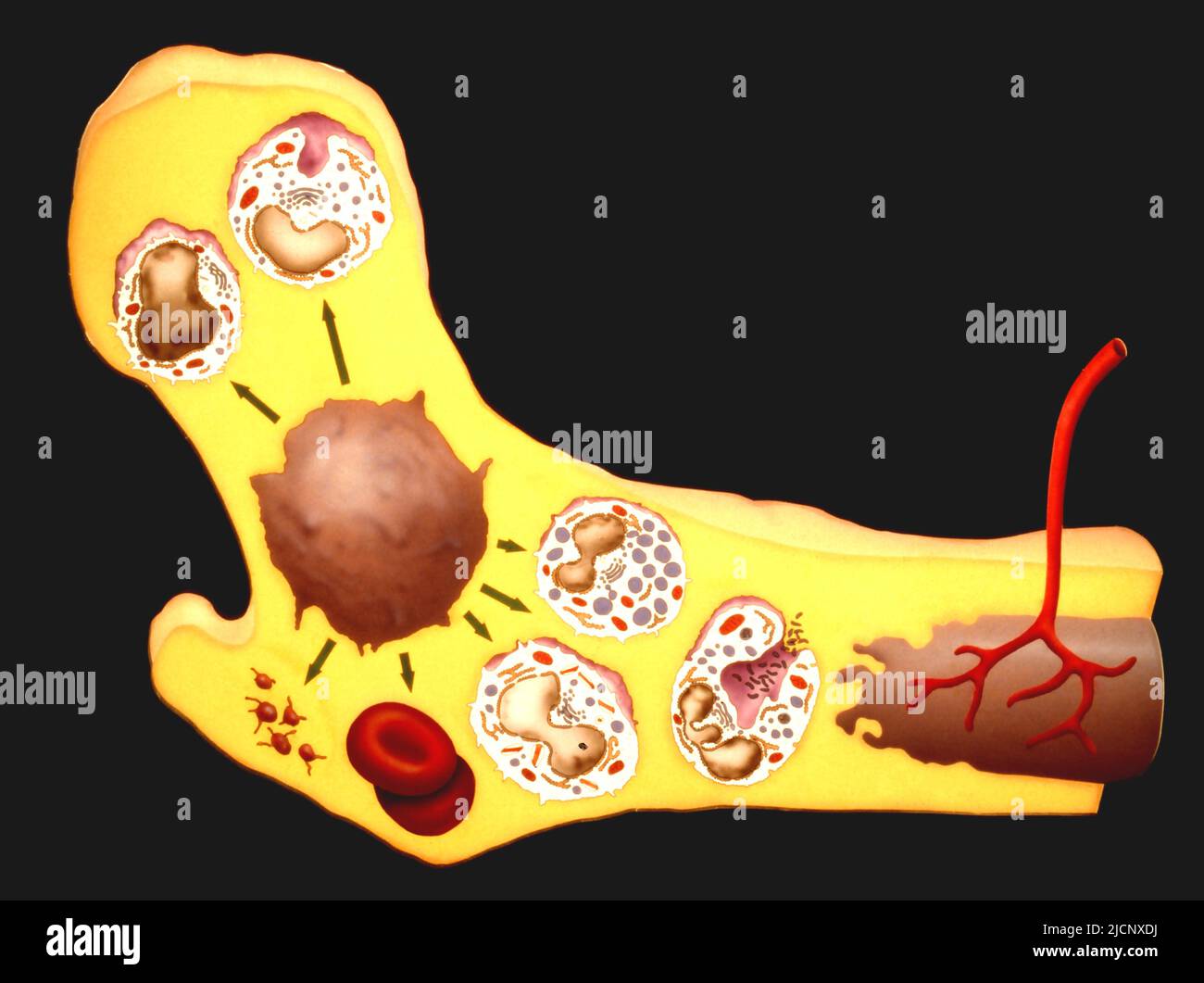 Producción de células sanguíneas. Ilustración que muestra una célula madre  hematopoyética (HSC, marrón) en la médula ósea. Esta célula forma los  precursores de cada tipo de célula sanguínea, incluyendo los glóbulos  blancos,