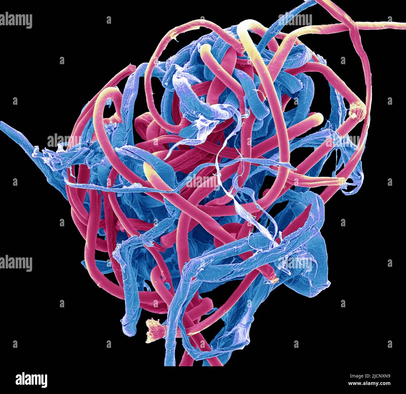 Bble microplástico. Micrografía electrónica de barrido de color (SEM