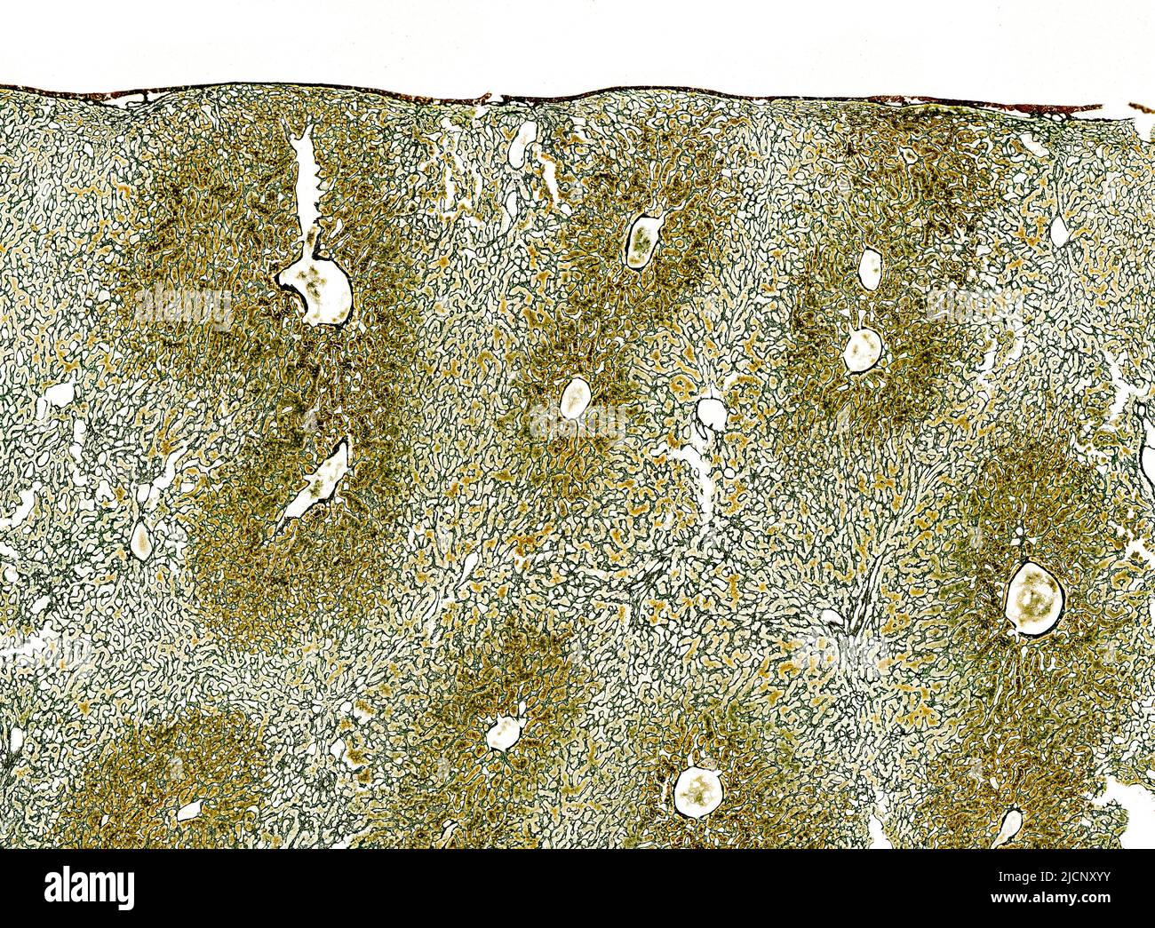 Micrografía ligera de tejidos hepáticos teñidos para mostrar el marco del  tejido conjuntivo que soporta los lobulillos del hígado. Este tejido  conectivo se conoce como fibras reticulares hechas de colágeno tipo III.