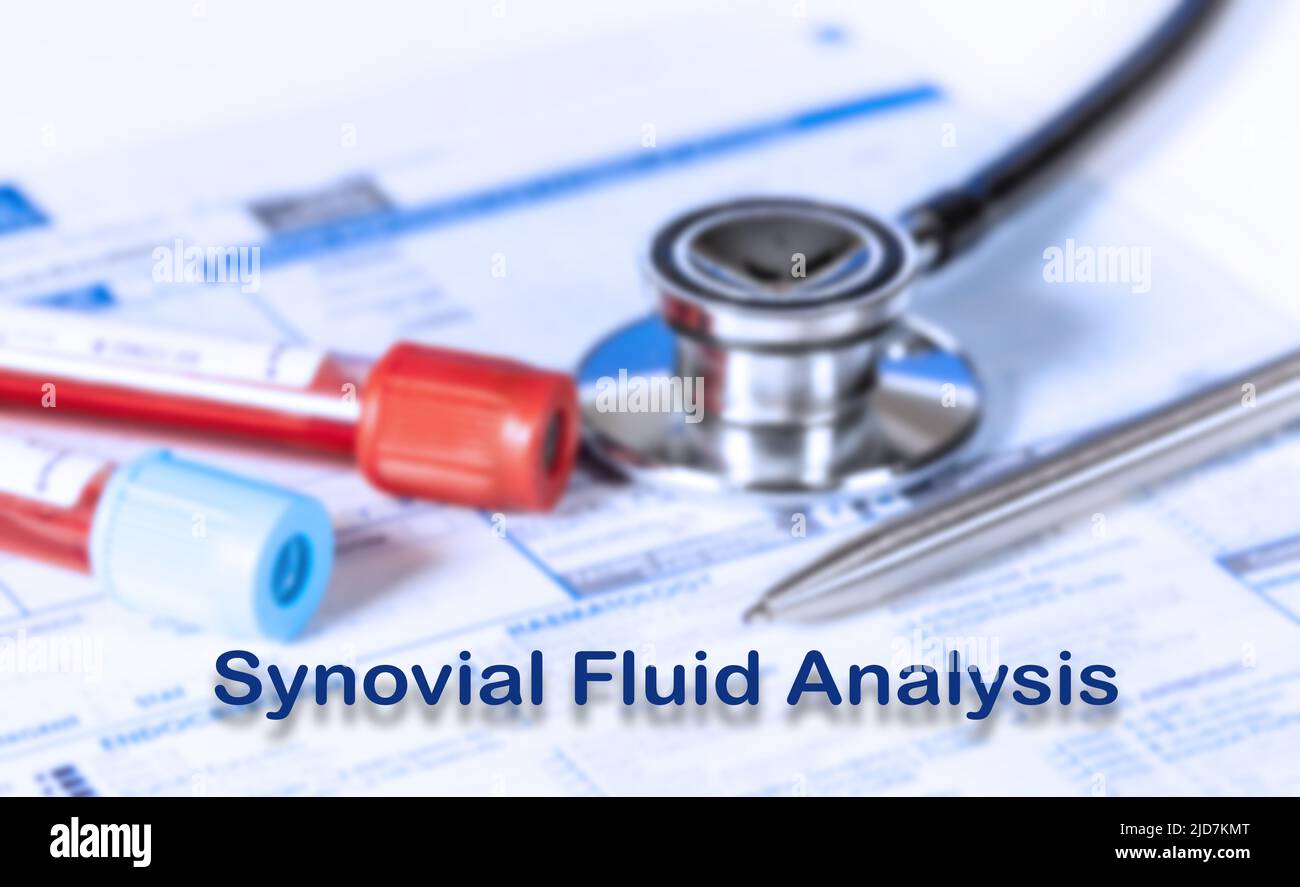 Análisis de fluidos sinoviales Concepto médico. Lista de exámenes médicos con texto y estetoscopio Foto de stock