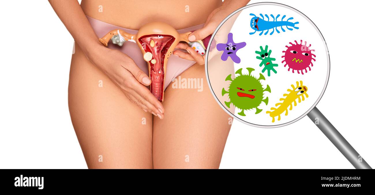 Concepto de infecciones bacterianas y virales del sistema reproductor femenino. Chequear y tratar enfermedades vaginales Foto de stock