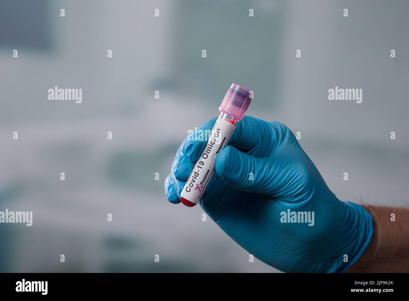 mano con un guante azul sujetando un tubo de análisis de sangre con marcador de corona positivo delante de una sala de laboratorio Foto de stock