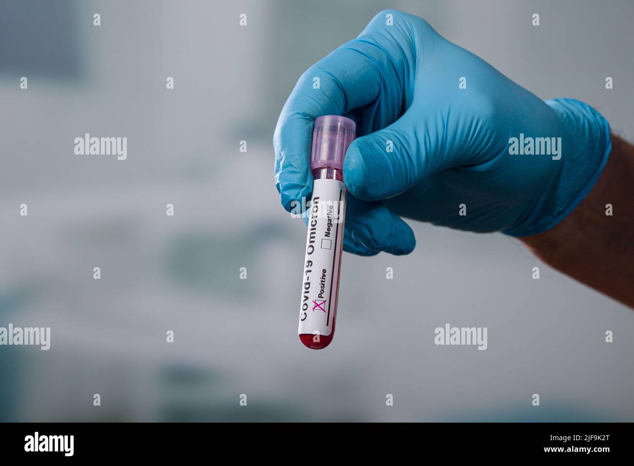 mano con un guante azul sujetando un tubo de análisis de sangre con marcador de corona positivo delante de una sala de laboratorio Foto de stock