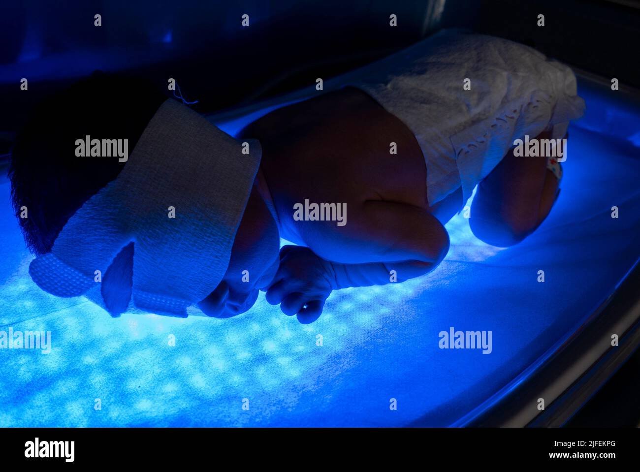 Bebé recién nacido acostado en cama de luz de fototerapia LED para tratar la ictericia Foto de stock