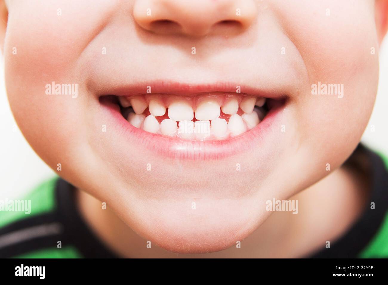 los dientes del niño sobre un fondo blanco aislado. Foto de stock