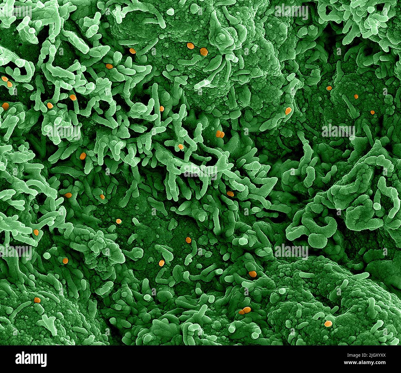 Viruela del simio. Micrografía electrónica de transmisión coloreada de partículas maduras del virus Nipah extracelular (rojo) cerca de la periferia de una célula VERO infectada (azul y verde). Imagen capturada en la Instalación Integrada de Investigación NIAID en Fort Detrick, Maryland. NIAID La viruela del simio es una enfermedad viral infecciosa que puede ocurrir en los seres humanos y en algunos otros animales.Los síntomas incluyen fiebre, ganglios linfáticos inflamados y una erupción que forma ampollas y luego costras. El tiempo transcurrido desde la exposición hasta el inicio de los síntomas varía de 5 a 21 días. La duración de los síntomas suele ser de 2 a 4 semanas. Foto de stock