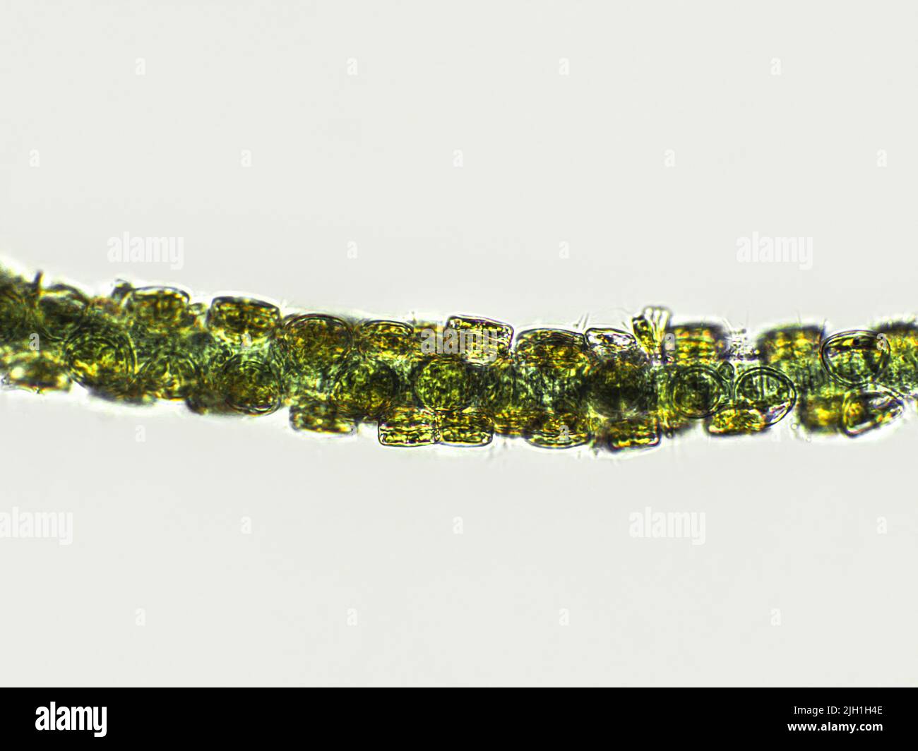 Algas filamentosas de color verde azulado bajo vista microscópica Foto de stock