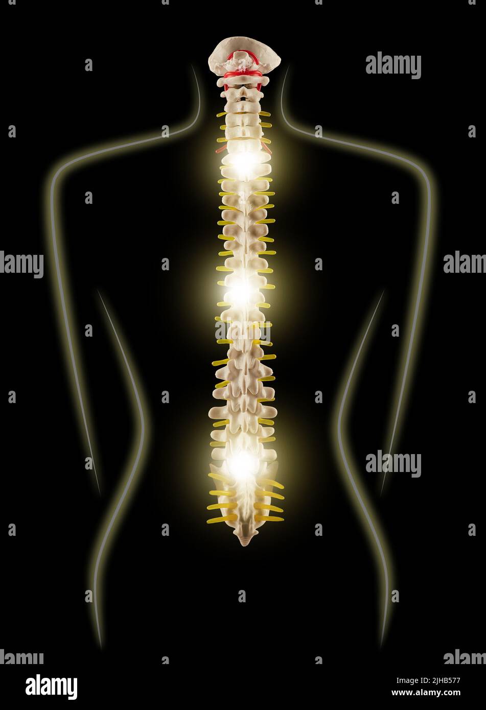 Salud de la columna vertebral. Silueta de mujer con columna brillante mostrando la salud de la columna vertebral, concepto Foto de stock