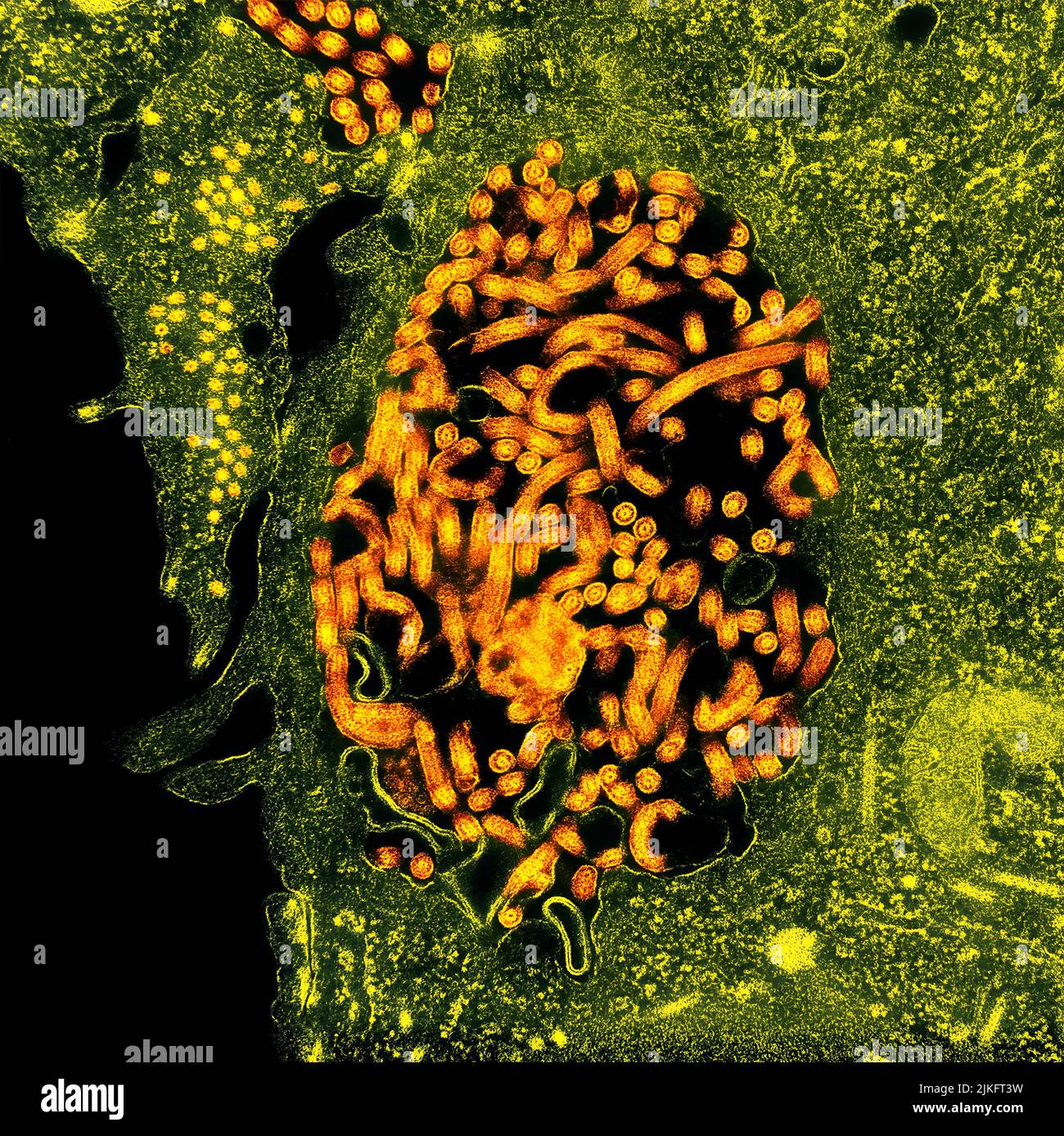 Micrografía electrónica de transmisión de nucleocápsidos del virus del Ébola (pequeños círculos naranjas) y partículas víricas (formas filamentosas naranjas más grandes) en células renales de monos verdes africanos infectadas. Imagen enfocada en el NIAID Integrated Research Center en Fort Detrick, Maryland. Foto de stock