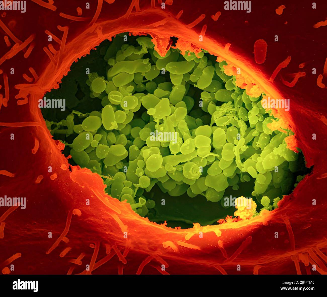 Esta imagen muestra la bacteria de la fiebre Q (amarilla), que infecta a vacas, ovejas y cabras en todo el mundo y también puede infectar a los seres humanos. Cuando se detecta temprano, la fiebre Q puede curarse con riesgos. Una pequeña fracción de la población puede desarrollar una forma crónica más grave de la enfermedad. Foto de stock