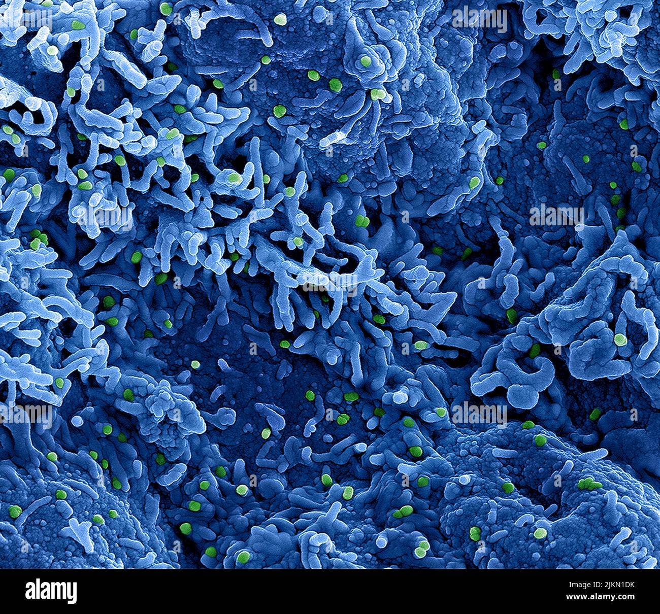 Virus de la viruela del simio Micrografía electrónica coloreada de las partículas de viruela del simio encontradas en una célula infectada , cultivada en el laboratorio. Imagen capturada y con color mejorado en la Instalación Integrada de Investigación NIAID (IRF) en Fort Detrick, Maryland. Crédito: NIAID Foto de stock