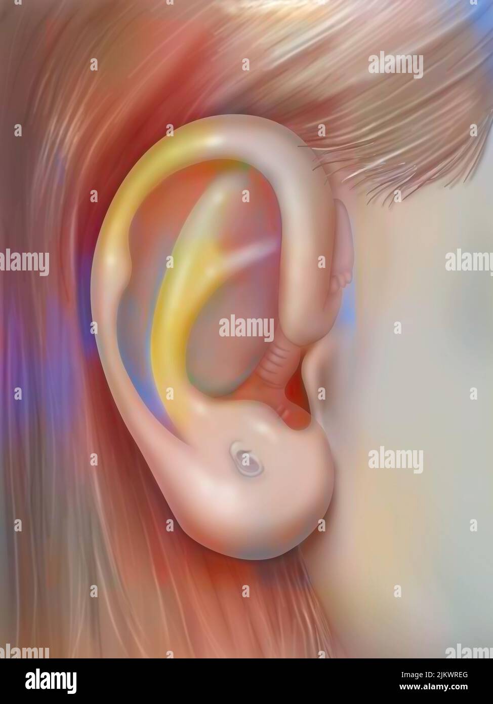 Auriculoterapia: Oído y evidencia de su semejanza con un feto. Foto de stock