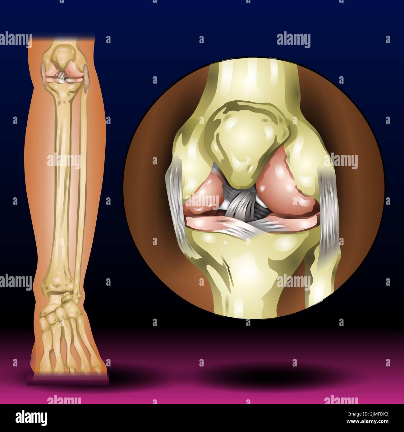 Lesiones de rodilla fotografías e imágenes de alta resolución - Alamy