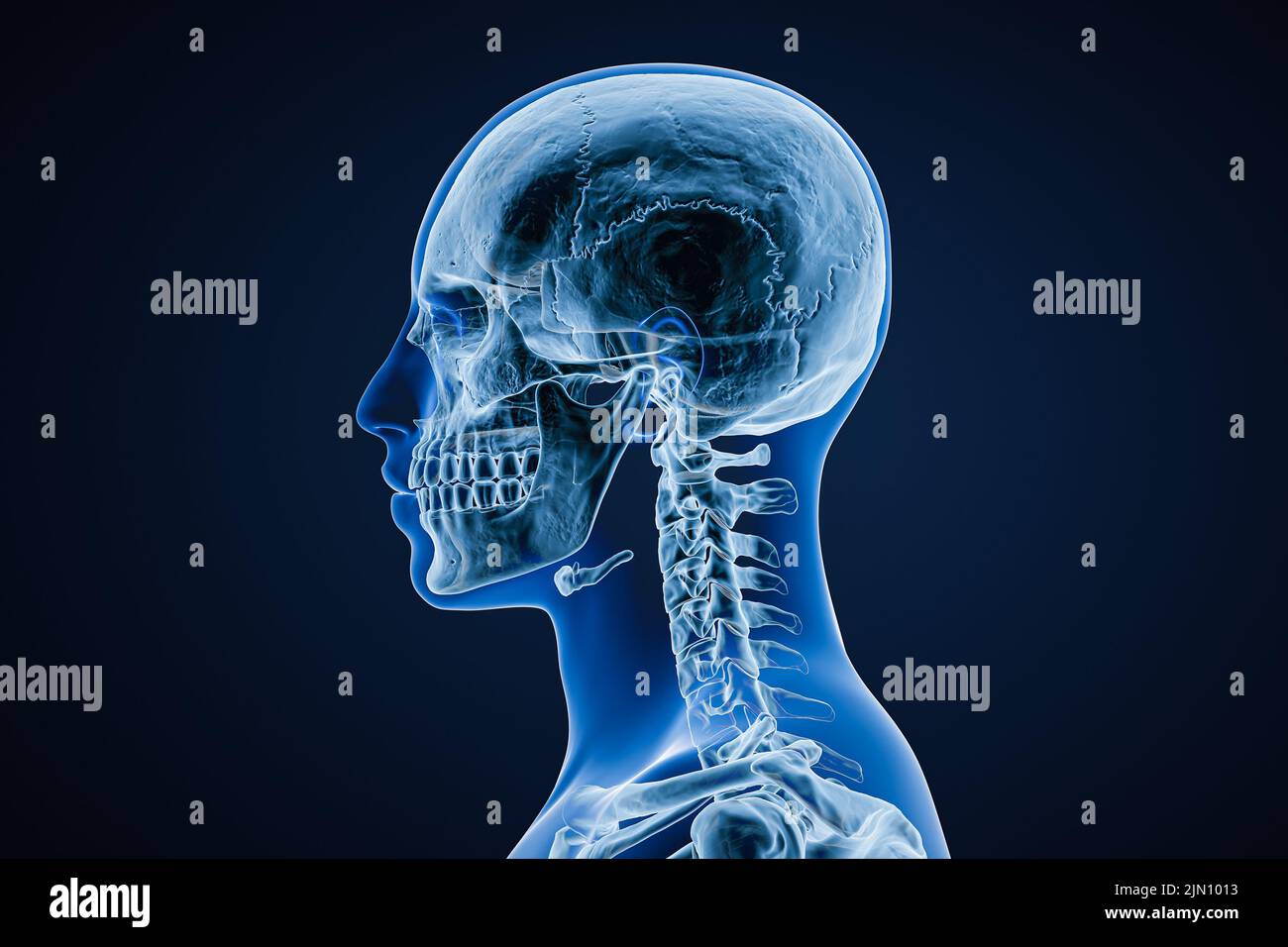 Imagen de rayos X de vista lateral o de perfil del cráneo de un varón adulto con contornos del cuerpo aislados sobre fondo azul 3D ilustración de representación. Anatomía, medici Foto de stock