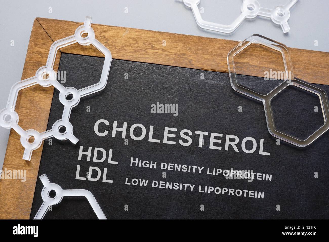 Pizarra con las palabras colesterol HDL y LDL. Foto de stock