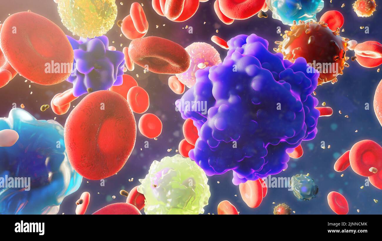 Ilustración de células sanguíneas con células tumorales circulantes. Aquí se muestran los glóbulos rojos (rojos), las células tumorales (púrpura oscuro), los linfocitos (anaranjados) y el neu Foto de stock
