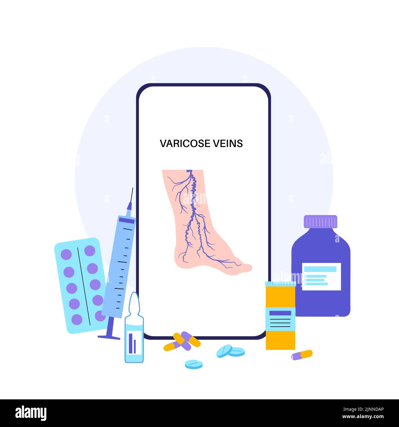 Tratamiento de venas varicosas, ilustración. Foto de stock