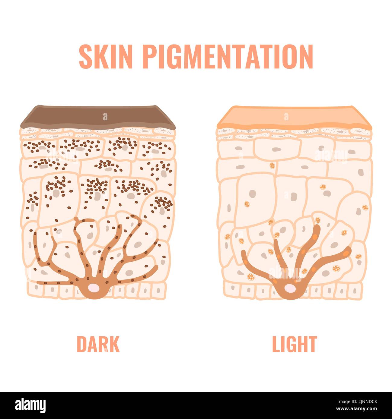 Diferencias en el color de la piel, ilustración. Foto de stock