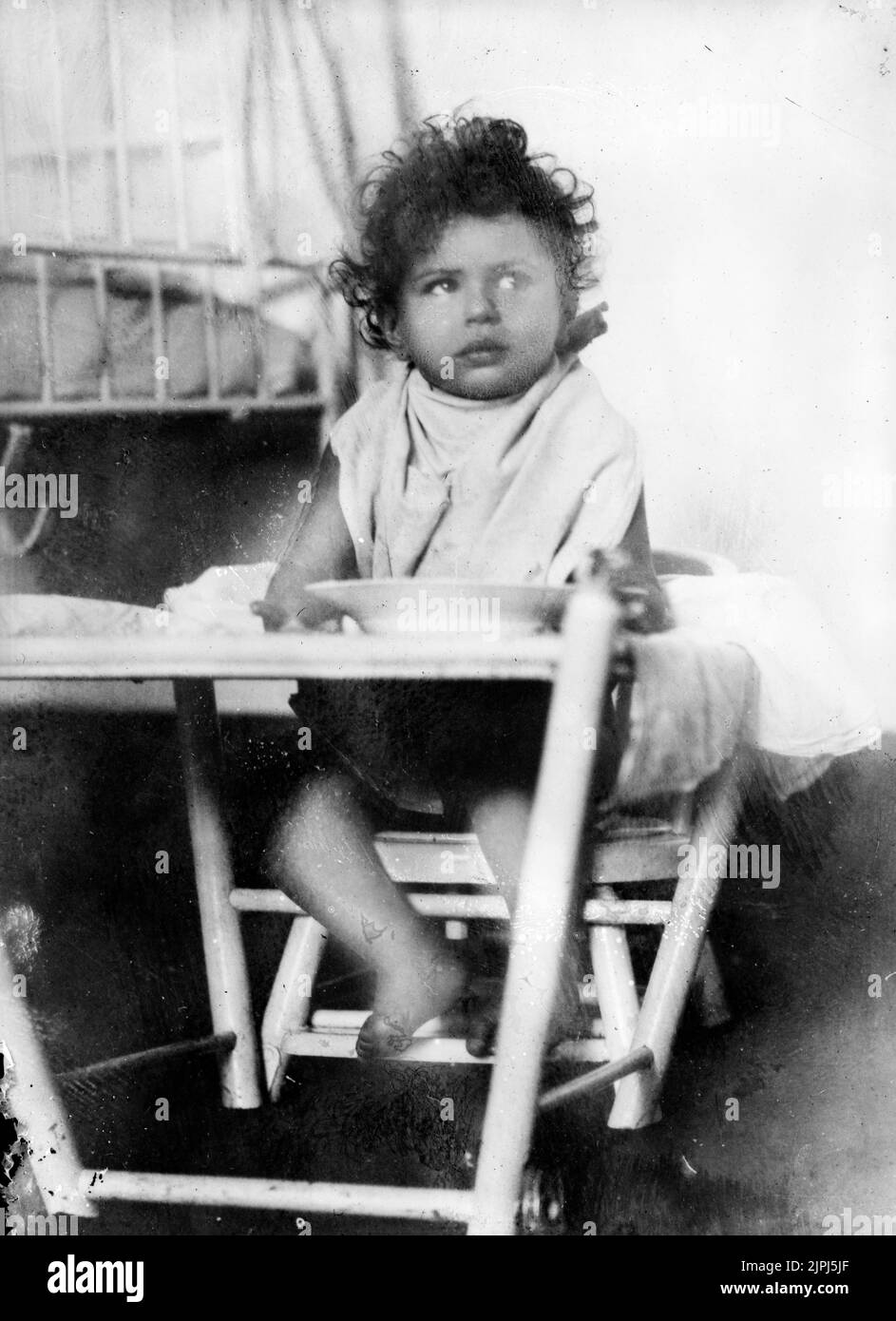 Niño ruso que padece tuberculosis, comiendo un plato preparado con leche condensada americana, proporcionado por la Cruz Roja en el Kinder Klinik de Viena, alrededor de 1920 Foto de stock