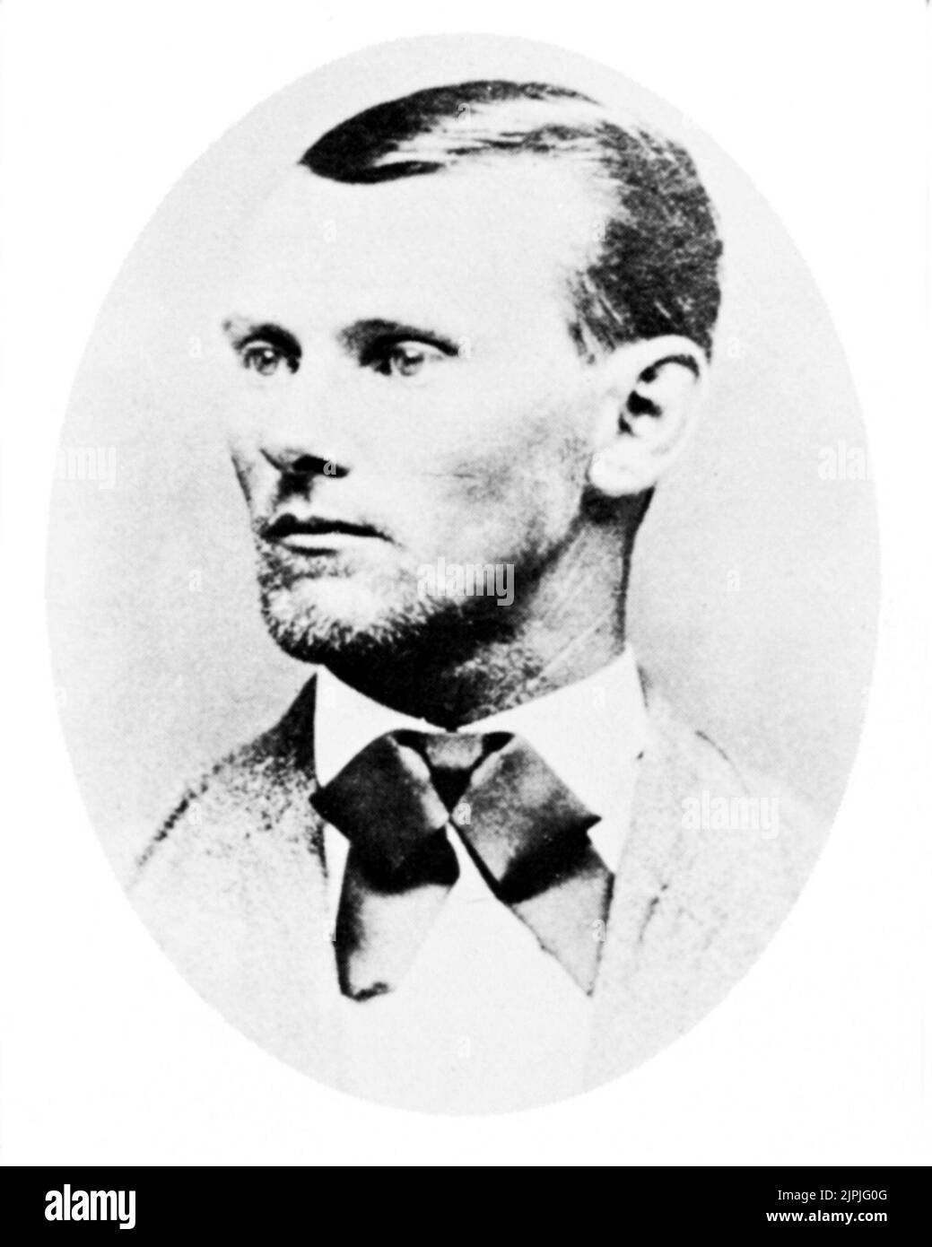 1870 ca, EE.UU. : El proscrito occidental JESSE JAMES ( Jesse Woodson James 1847 - 1882 ) - Selvaggio WEST - epopea del - FUORILEGGE - bandito - collar - colletto - tie papillon - cravatta --- Archivio GBB Foto de stock