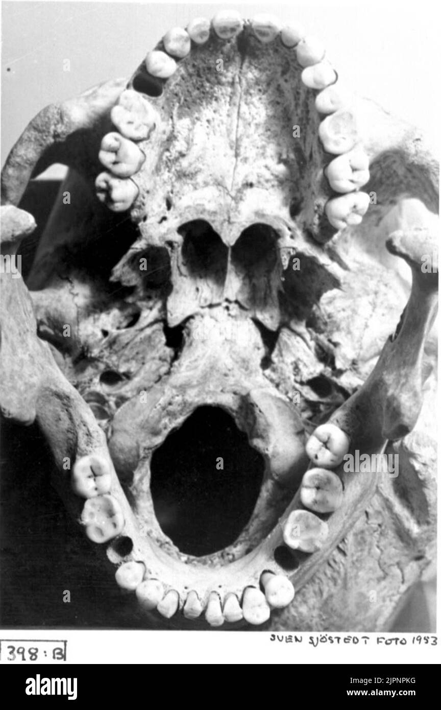 Tumba 9. Primer plano de un cráneo. Grav 9. Närbild av ett kranium. Foto de stock