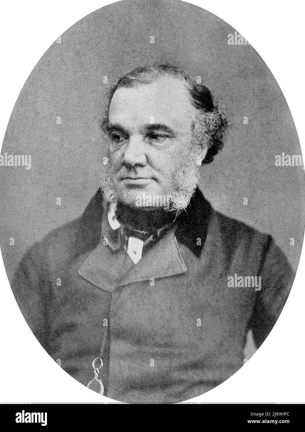 THOMAS ADDISON (1793-1860) Médico y científico inglés Foto de stock