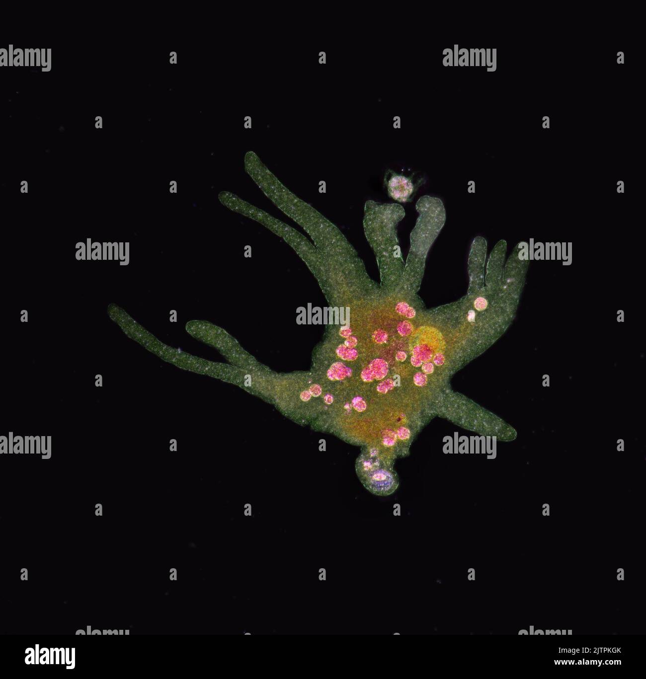 Ameba Proteus, muestra teñida, Foto de stock