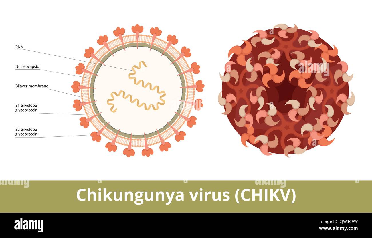 Virus Chikungunya Chikv Un Virus Arn Un Miembro De La Familia Togaviridae Causa La