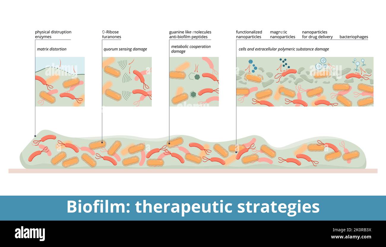 Biofilm: Estrategias terapéuticas. Tratamiento de biofilm: Alteración física (enzimas), daño de detección de quórum (D-ribosa), daño de cooperación metabólica Ilustración del Vector