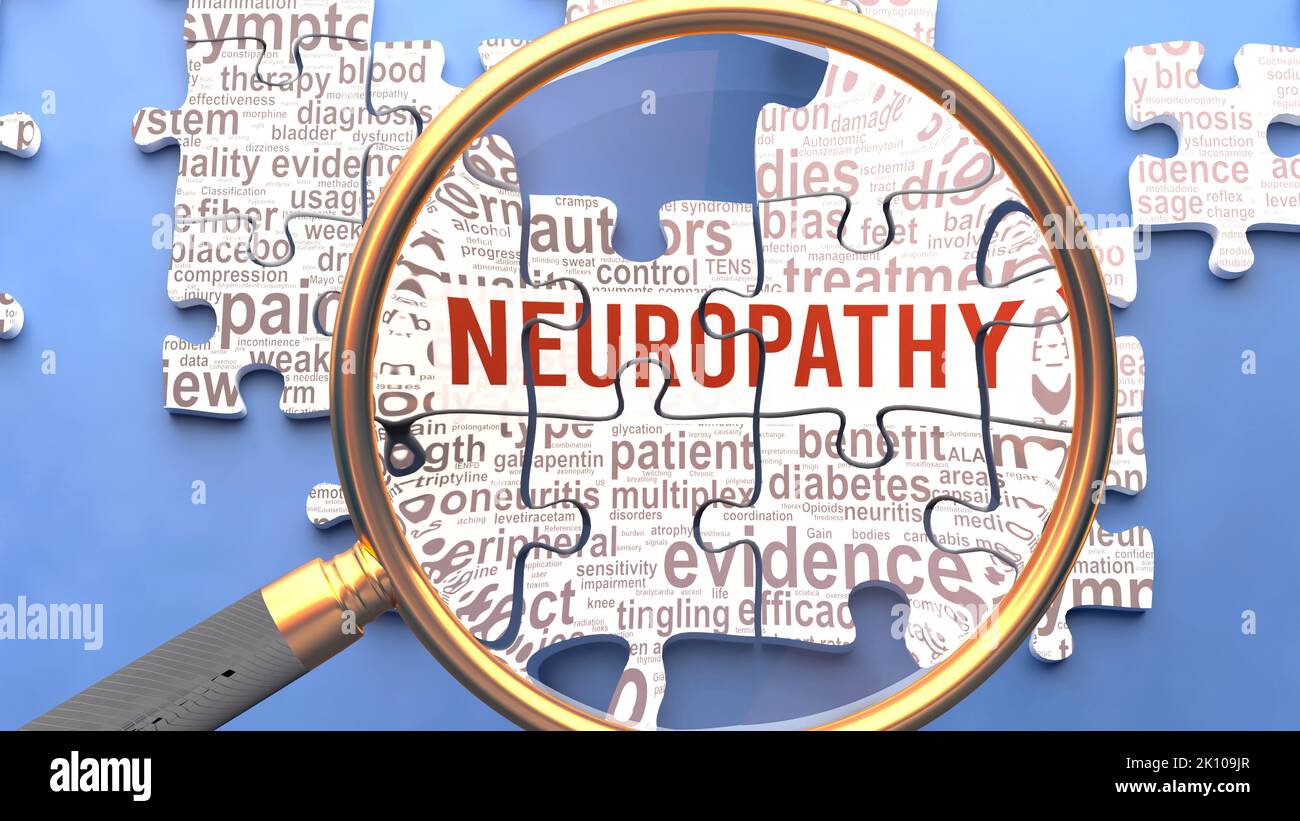 La neuropatía como un tema complejo y multiparitario bajo estrecha inspección. La complejidad se muestra como piezas de puzzle coincidentes que definen docenas de ideas vitales y conc Foto de stock