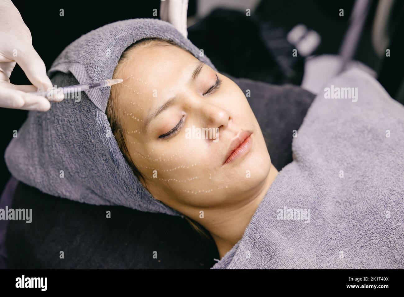 Lady Teen proceso de eliminación de arrugas faciales por inyección de toxina botulínica estiramiento facial en la clínica con la mano del médico Foto de stock