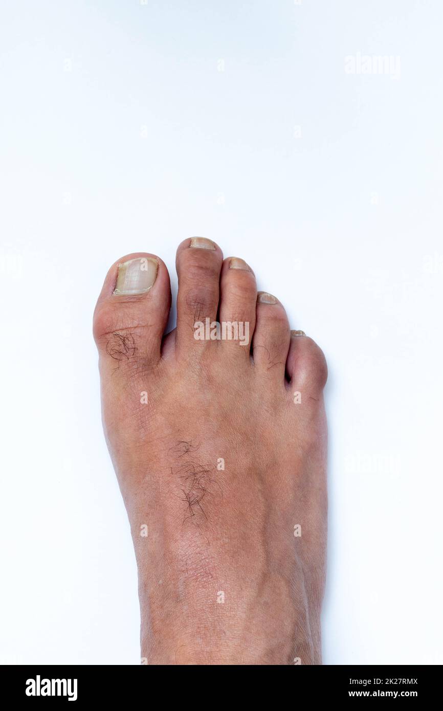 Dedos de los pies, manos y uñas. Partes masculinas del cuerpo humano de 20 a 30 años de edad Foto de stock