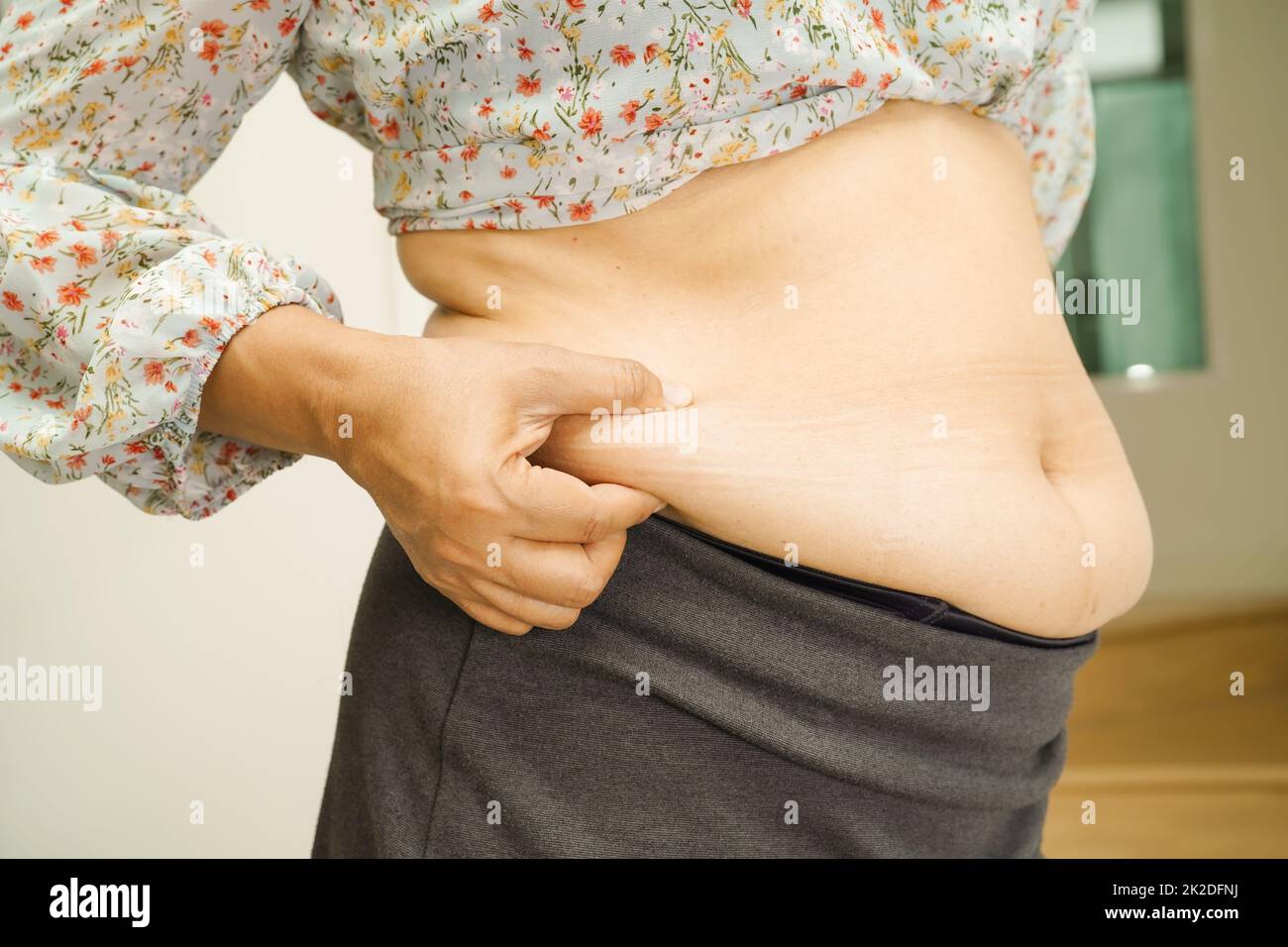 Una mujer asiática con sobrepeso muestra y utiliza la mano para apretar el vientre gordo. Foto de stock