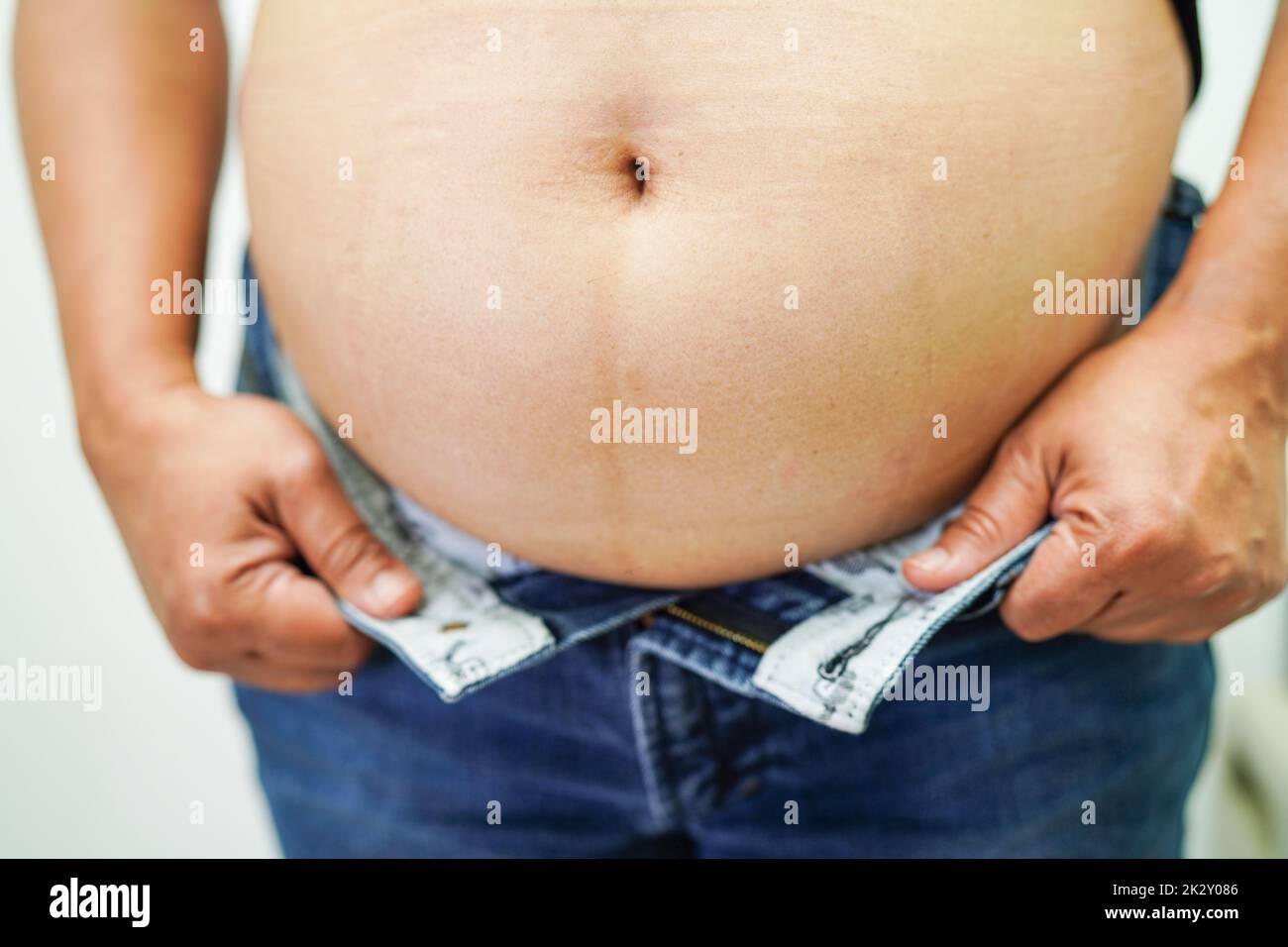Mujer asiática mostrar gorda vientre grande sobrepeso y obesidad en la oficina. Foto de stock