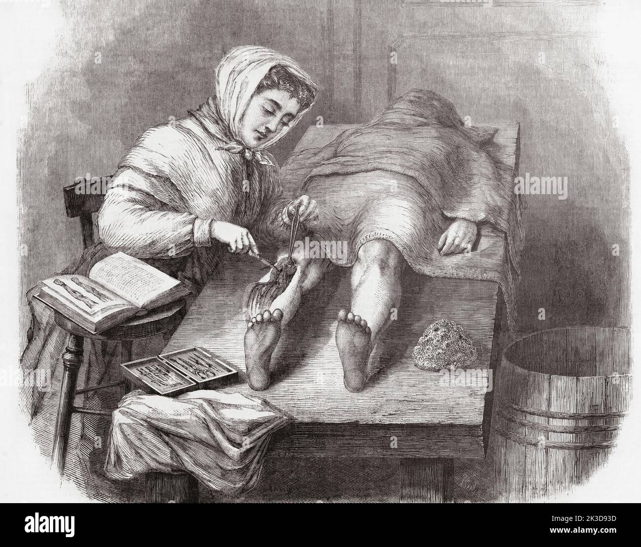 Una estudiante disecando una pierna en el Colegio Médico para Mujeres en East Twelfth Street y Second Avenue, Nueva York, EE.UU. Después de una ilustración de una edición de 1870 del periódico ilustrado de Frank Leslie. Foto de stock